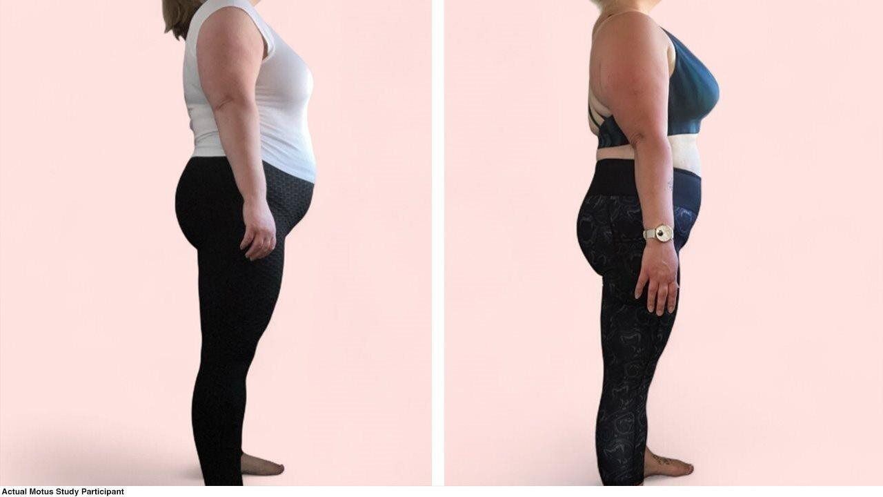 Science-backed alternatives for people who can't get a GLP-1